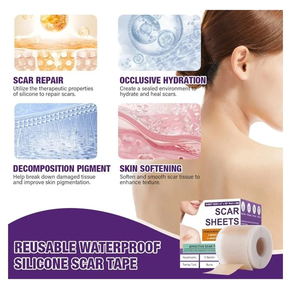 Silicone Scar Sheets,Silicone Scar Tape,Scar Tape For Surgical Scars,Silicone
